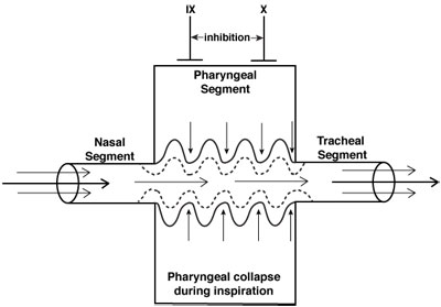 Pharyngeal Collapse diagram