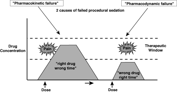 Two Causes of Failed Procedural Sedation