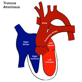 Truncus Arteriosus (Truncus)